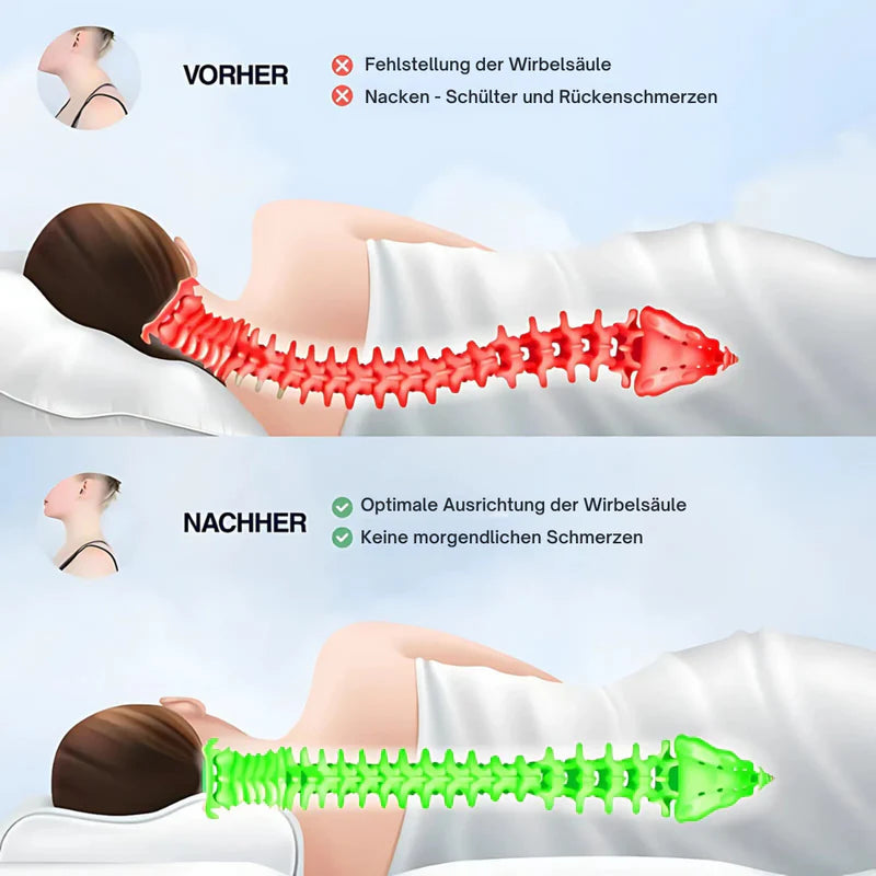 Der ErgoFlügel: Orthopädisches Schmetterlingskissen mit Armfreiheit
